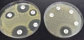 تعیین خواص ضد میکروبی (باکتری و مخمر) نمونه های گیاهی و سنتزی و...